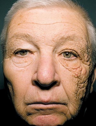 Oldskin.jpeg (Slideshow) Oldskin.jpeg (Slideshow)