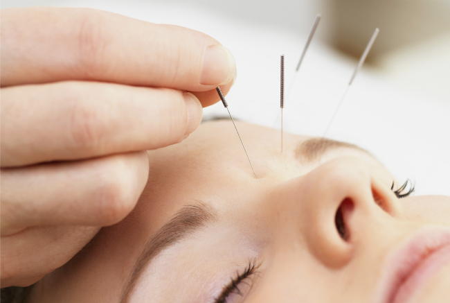 Acupuncture for Weight Loss: What You Need to Know