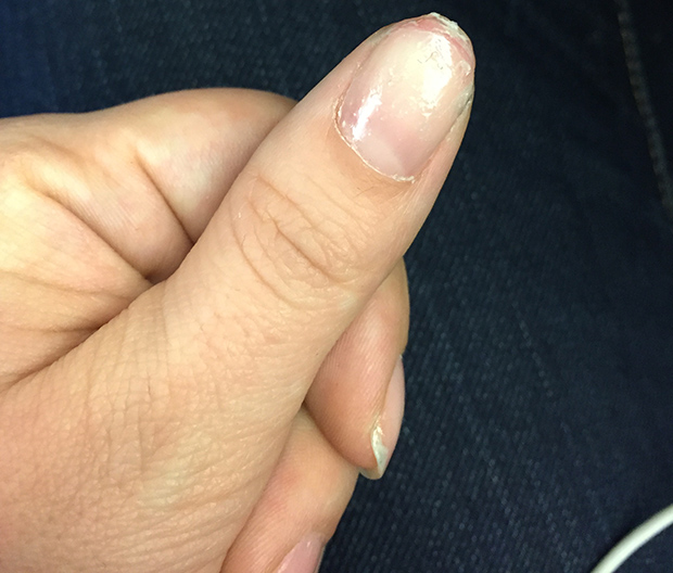 The Dangers Of The Gel Manicure A Cautionary Tale Stylecaster